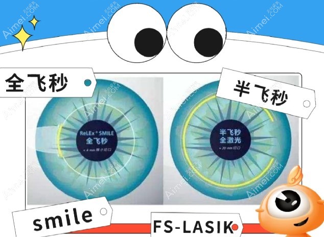 全飞秒、半飞秒和个性化半飞秒激光近视手术哪个好爱美网 全飞秒、半飞秒和个性化半飞秒激光近视手术哪个好爱美网
