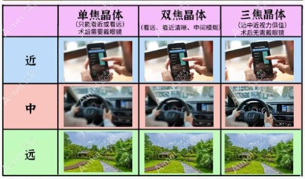 白内障人工晶体不同种类作用 白内障人工晶体不同种类作用