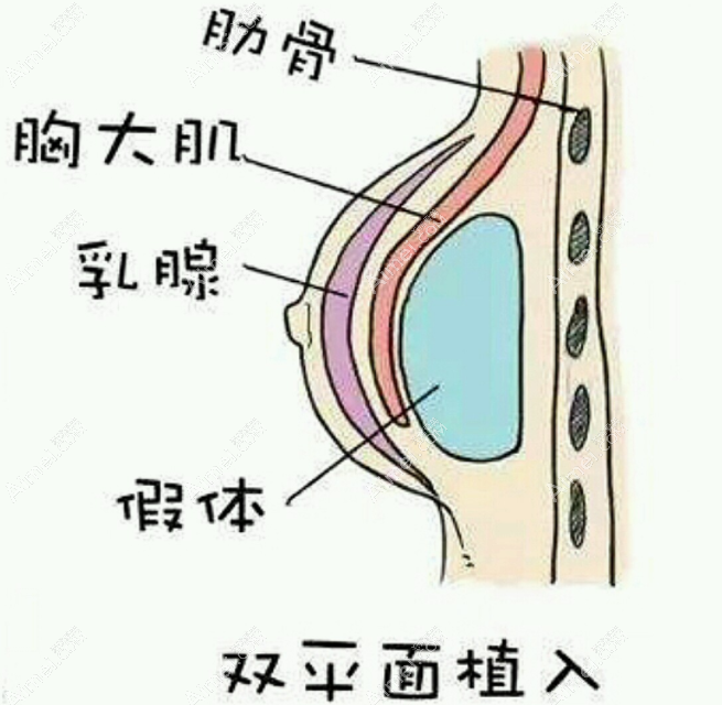 刘杰伟做假体隆胸术后胸型好看 刘杰伟做假体隆胸术后胸型好看