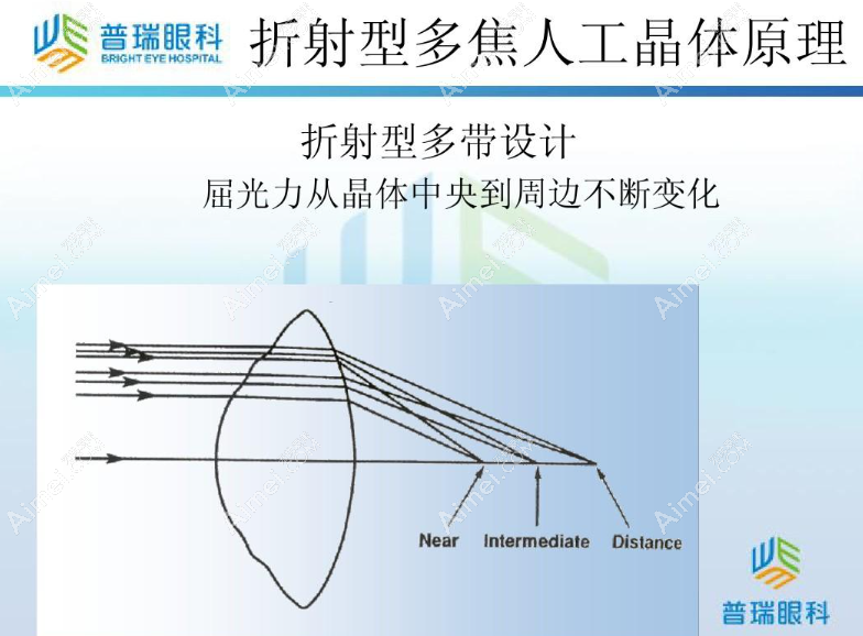 区域折射型晶体优缺点 区域折射型晶体优缺点