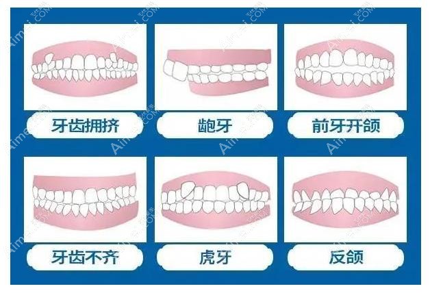常德辰星口腔牙齿矫正哪个医生好 常德辰星口腔牙齿矫正哪个医生好