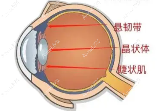 单焦点人工晶体品牌推荐 单焦点人工晶体品牌推荐