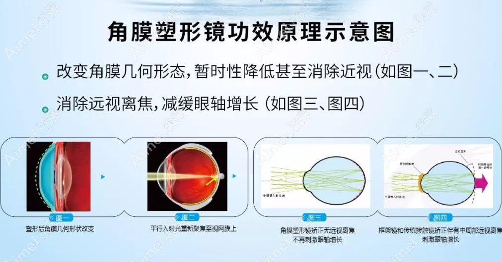 广州角膜塑形镜多少钱一副?广州希玛-爱尔眼科配OK镜5000元起