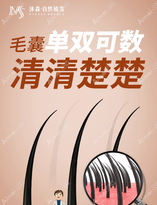 西安沐森植发价格透明 西安沐森植发价格透明