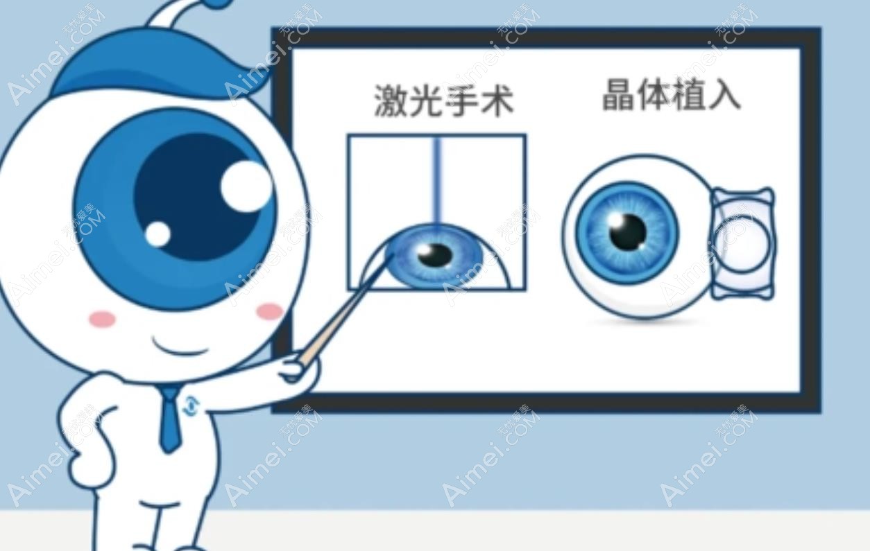 近视手术类型 近视手术类型