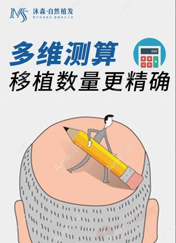 西安沐森植发怎么样 西安沐森植发怎么样