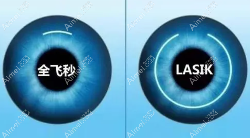 常州近视眼300/600/1000度手术费用8000起800元 常州近视眼300/600/1000度手术费用8000起800元