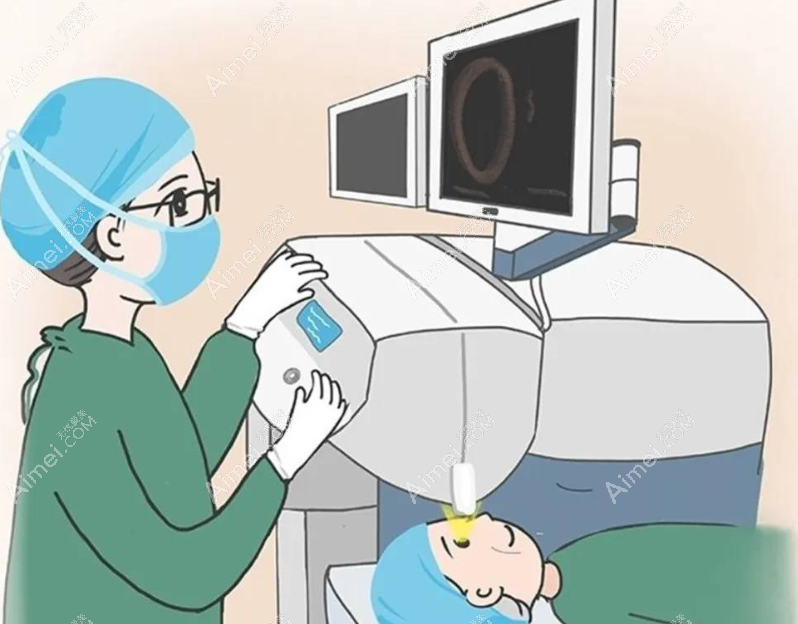 半飞秒激光近视手术什么时候可以用手机