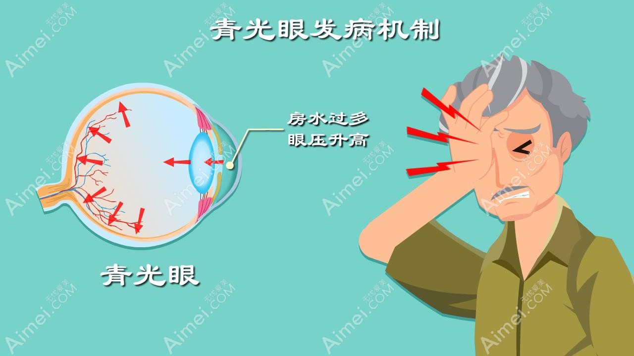 选择性激光小梁成形术优缺点:痛感小,会出现短暂性眼压升高