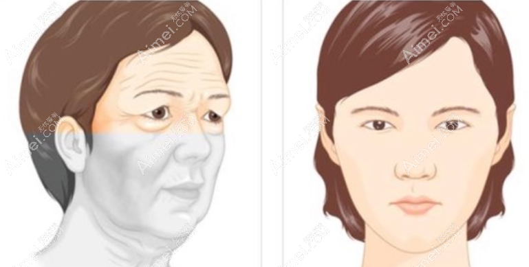 黄广香拉皮手术做的好在国内排前十,坐诊中家医要提前预约