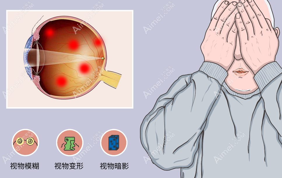 重庆何氏眼科医院陈少军医生做眼底病手术怎么样