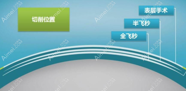 临沂华厦眼科医院矫正近视怎么样 临沂华厦眼科医院矫正近视怎么样