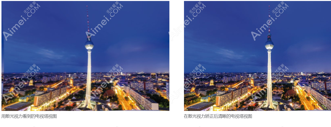 蔡司709人工晶体植入前后视力对比图片