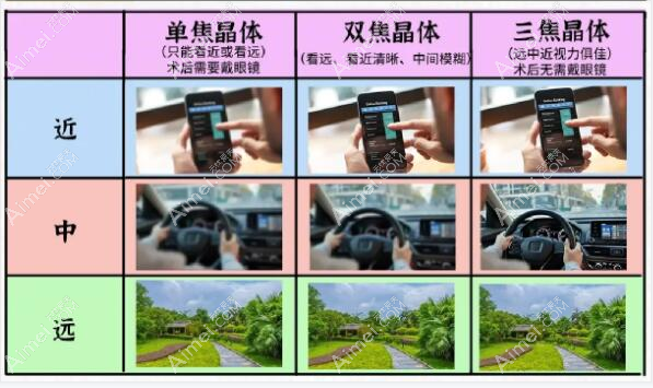 长沙白内障晶体植入手术疗效