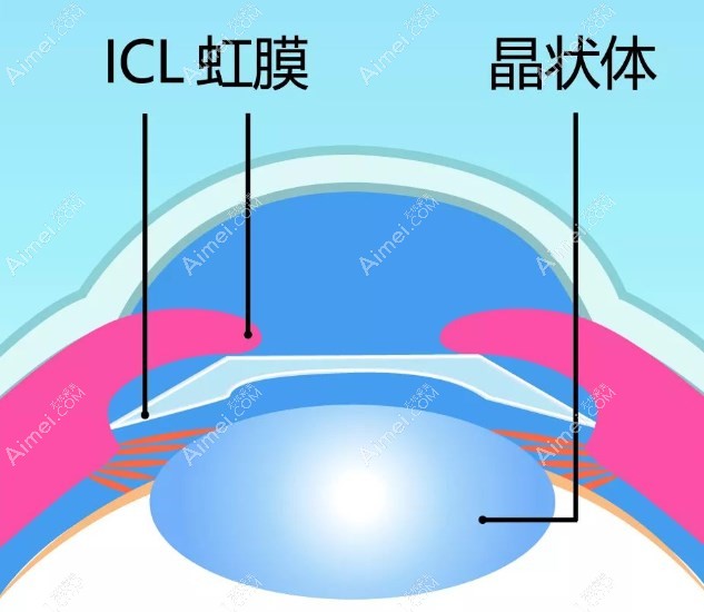 李海燕眼科医生靠谱 李海燕眼科医生靠谱
