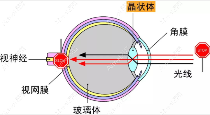 常州白内障手术费用8000,指定医院有白内障手术免费报销政策