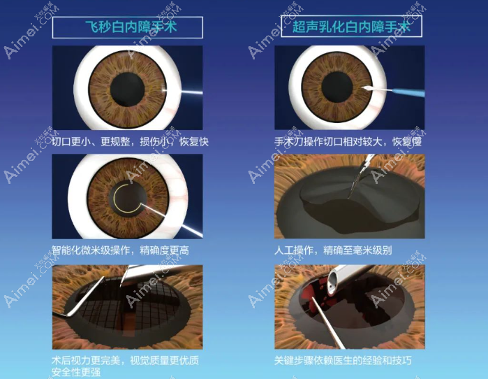 常见白内障类型及治疗方法汇总 常见白内障类型及治疗方法汇总