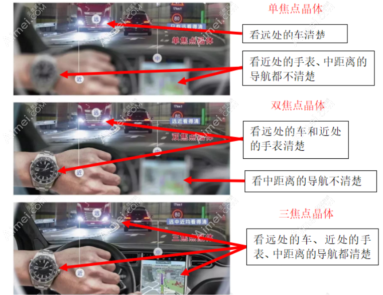 白内障单焦双焦三焦晶体区别 白内障单焦双焦三焦晶体区别