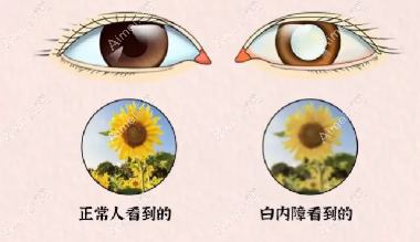 大连白内障手术哪家医院做的好?大连爱尔/连锁何氏排名前三