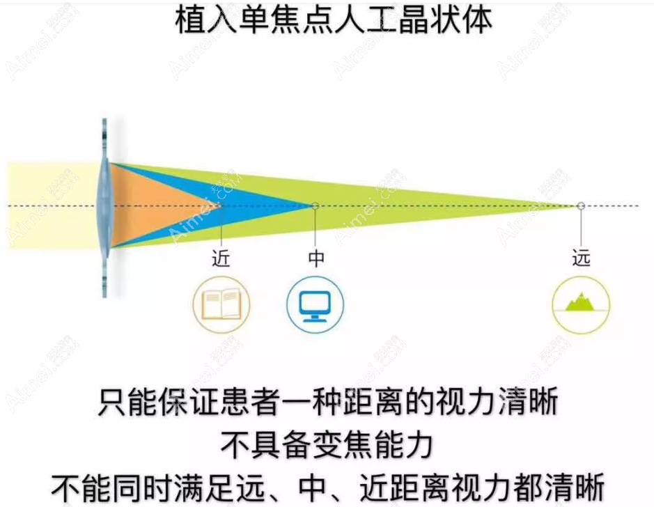 白内障单焦晶体能不能满足开车要求?能,单焦远视力适合开车