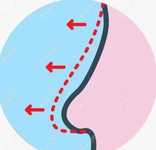 汉中华美奥莱陈昴做鼻子怎么样www.aim/ei.com
