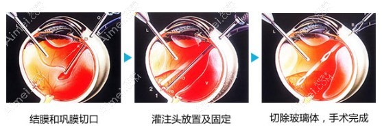 昆明康特森眼科医院王慧简历介绍 昆明康特森眼科医院王慧简历介绍