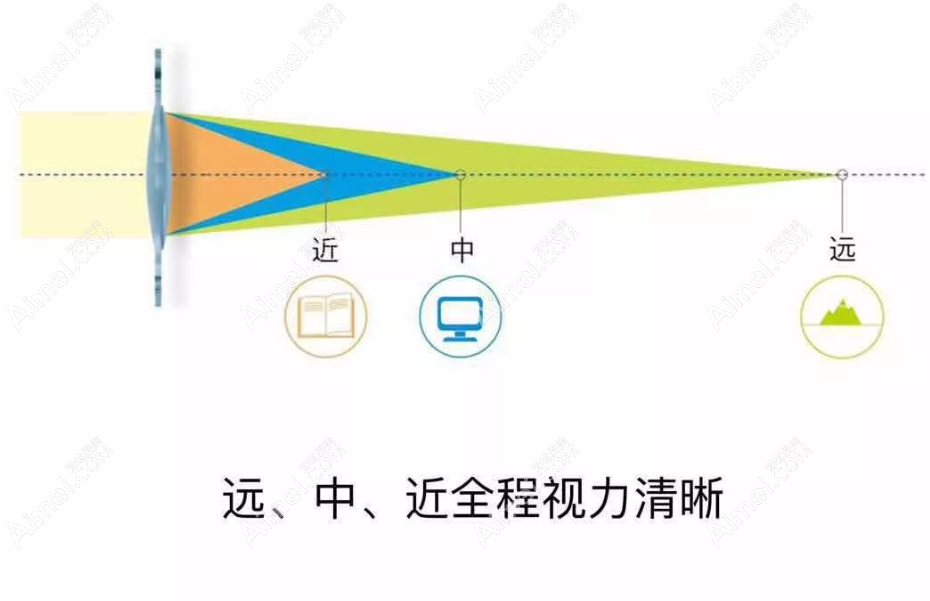 植入三焦晶体看东西模糊不清 植入三焦晶体看东西模糊不清