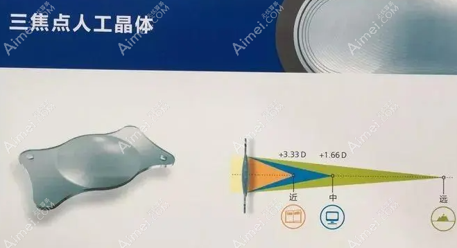 高度近视加白内障好的治疗方法 高度近视加白内障好的治疗方法
