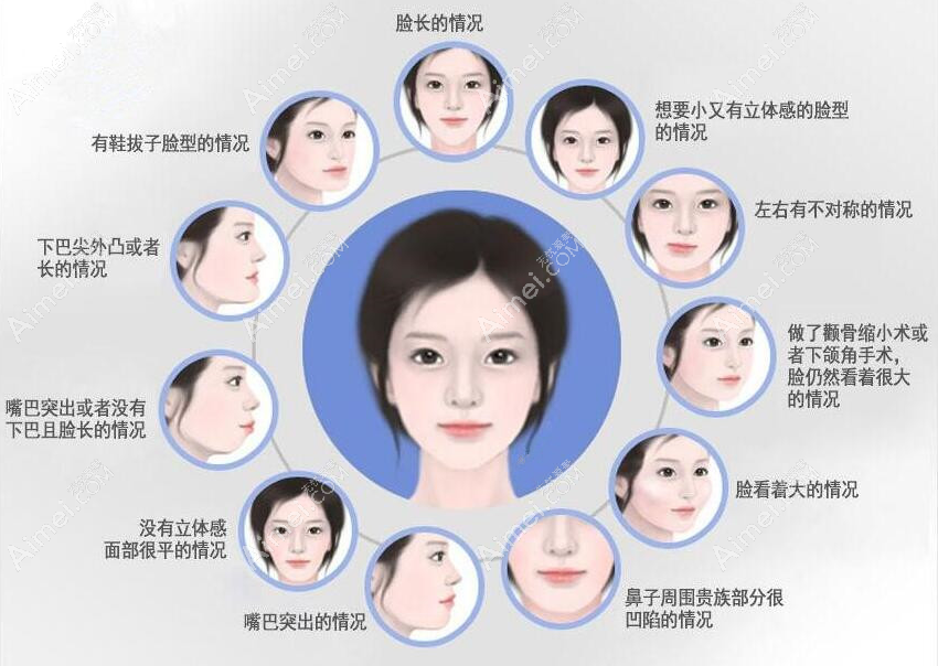 广州广大医院正颌手术怎么样?好,做嘴突正颌实例多,费用4万+