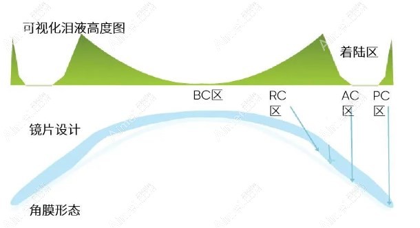 视达佳ok镜控制视力成效好 视达佳ok镜控制视力成效好