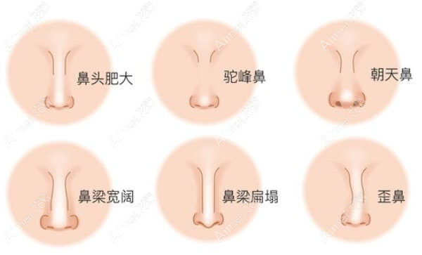 国内很难预约10大隆鼻医生:刘彦军--李信锋有名难预约