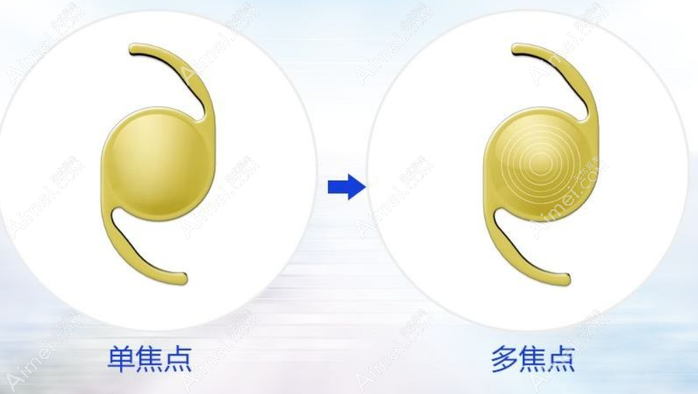 老年人眼外伤晶体摘除后植入哪种人工晶体好 老年人眼外伤晶体摘除后植入哪种人工晶体好