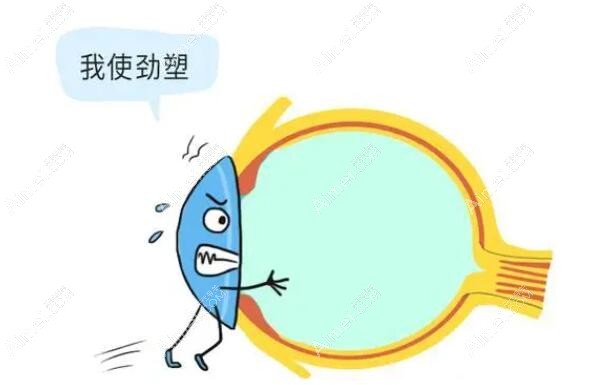 常州角膜塑形镜价格不贵 常州角膜塑形镜价格不贵