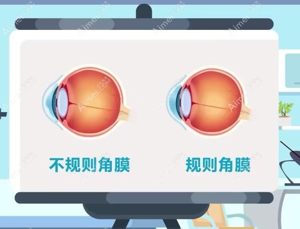 巩膜镜的作用是什么 巩膜镜的作用是什么