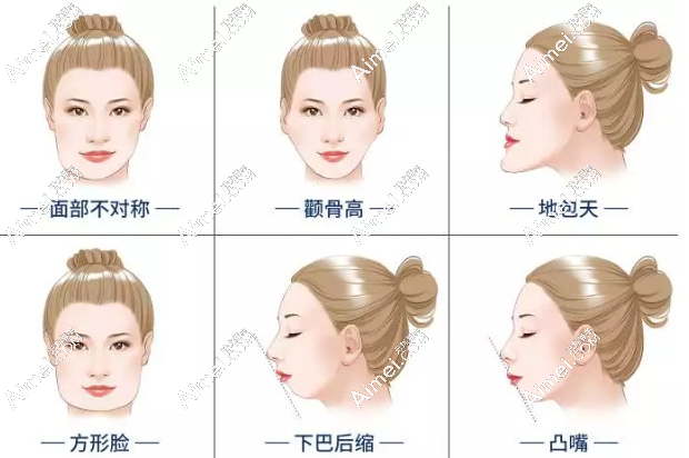 北京圣嘉新整形医院磨骨技术好的医生有谁 北京圣嘉新整形医院磨骨技术好的医生有谁