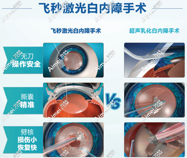 深圳希玛林顺潮眼科白内障手术怎么样 深圳希玛林顺潮眼科白内障手术怎么样