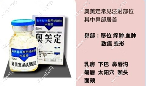 西安国医鼻子奥美定取出创伤小 西安国医鼻子奥美定取出创伤小