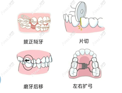 连锁牙科正畸技术可靠 连锁牙科正畸技术可靠