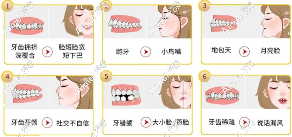 2023中诺口腔正畸7000起 2023中诺口腔正畸7000起