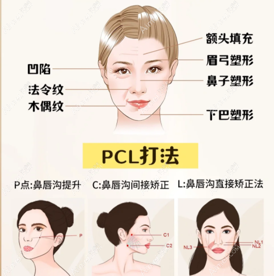 广州曙光-美莱是少女针授权医院技术好 广州曙光-美莱是少女针授权医院技术好