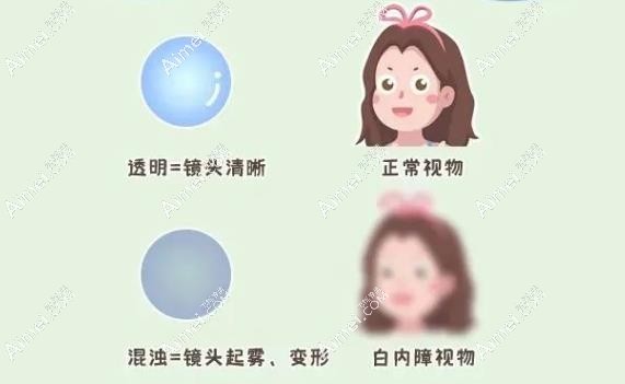郑州做白内障手术好的医院排名:前3家做白内障费用便宜又好