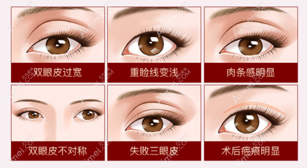 杜园园双眼皮修复技术真的好