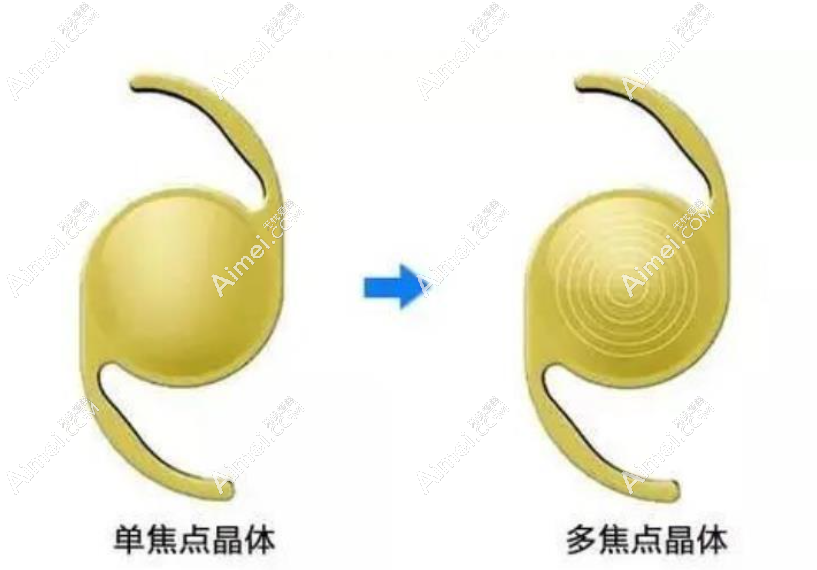 多焦点人工晶体可以报销吗 多焦点人工晶体可以报销吗