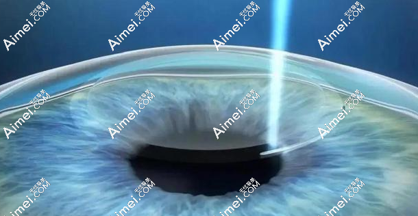 杭州眼睛近视做激光哪里医院好?茗视佳-爱尔眼科做全飞秒好