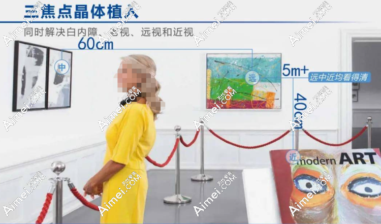 三焦点晶体就是全焦点人工晶体吗?不是,三焦全焦晶体区别大