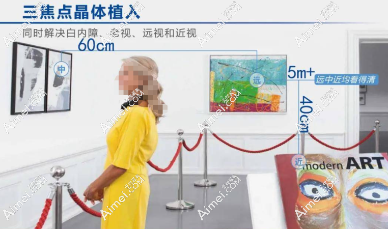 蔡司839mp三焦点人工晶体术后成效 蔡司839mp三焦点人工晶体术后成效