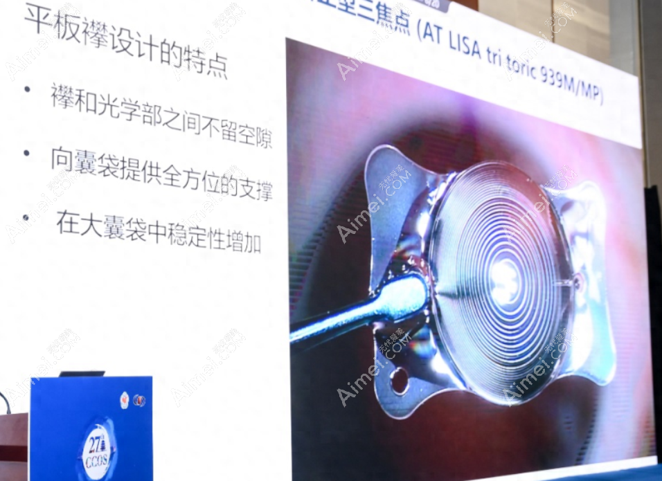 蔡司939mp三焦点散光人工晶体怎么样 蔡司939mp三焦点散光人工晶体怎么样