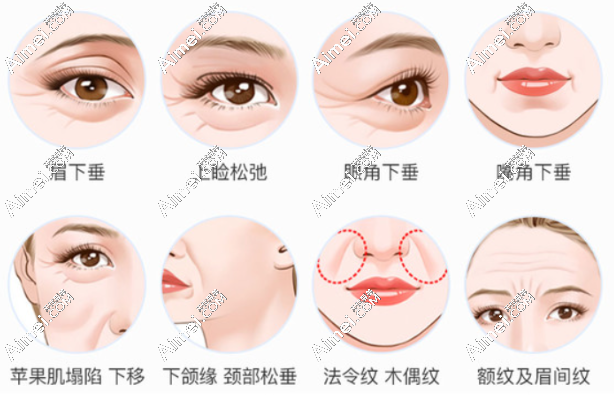 穆宝安V美减龄好吗 爱@美网 穆宝安V美减龄好吗 爱@美网