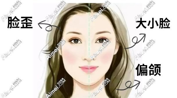 偏颌的样子图片m.dlren.com 偏颌的样子图片m.dlren.com