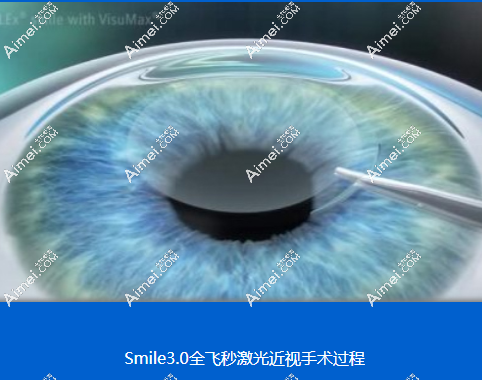 佰视佳眼科做全飞秒近视手术好 佰视佳眼科做全飞秒近视手术好